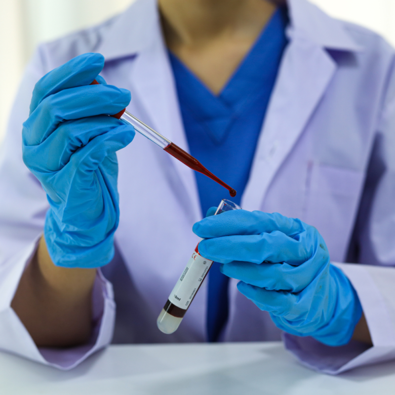 Aldosterone e Renina: nuove linee guida della Endocrine Society e alcuni approfondimenti